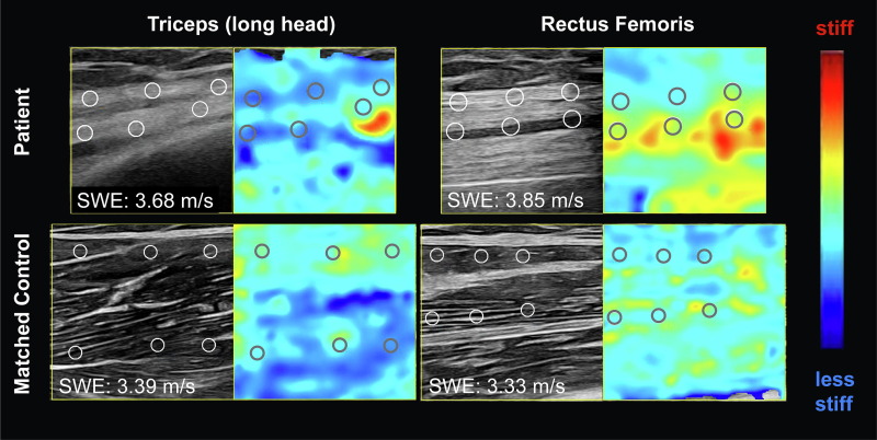 IFCN and its Clinical Neurophysiology journals tweet media