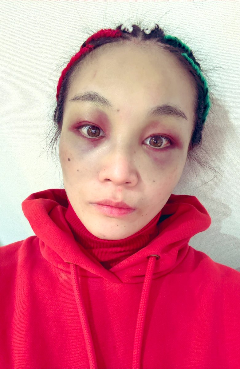 山家 七恵【はみ】Nanae Yamaka tweet media