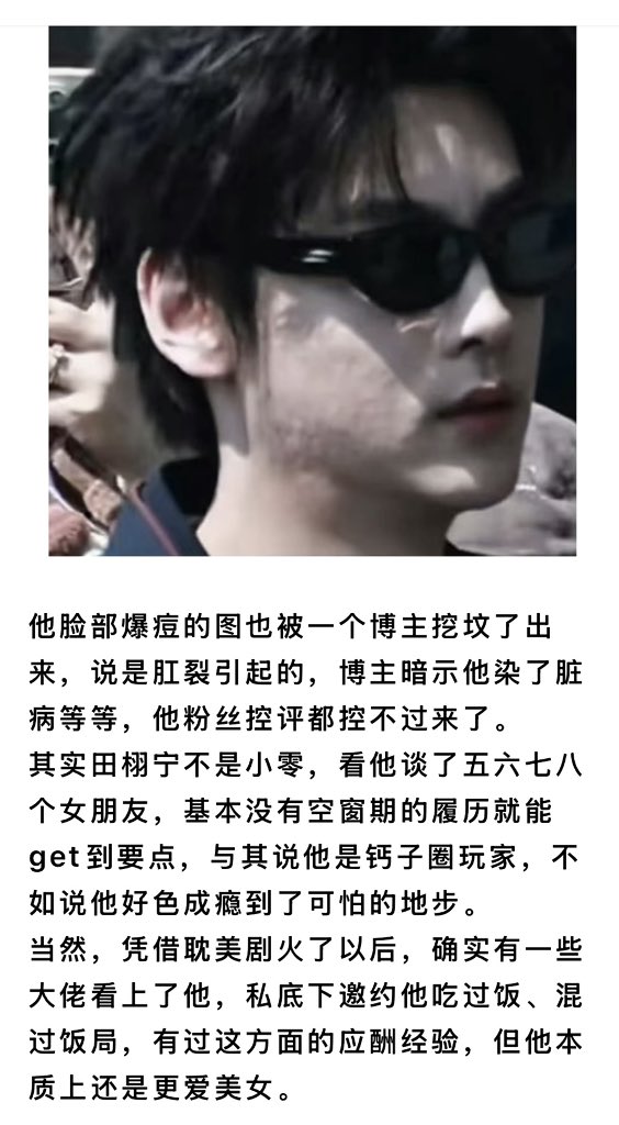 cnmdsbgun's tweet photo. 建议所有和田雷有过负距离接触的都去查查身体 https://t.co/C4Fg8DZcYR