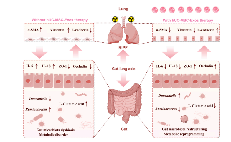 exosome's tweet image. #stemcell #exosomes protect lungs from #radiation in part by fixing #microbiome

pubmed.ncbi.nlm.nih.gov/41565402/