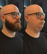 Opiumbrella's tweet image. Ahem…👇