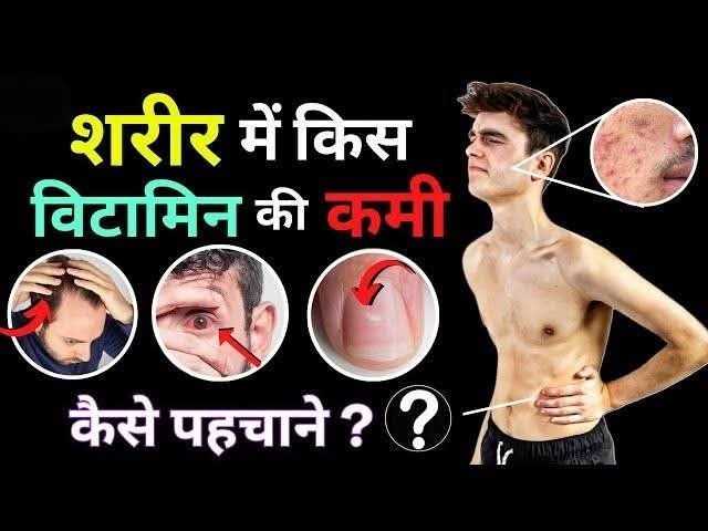 क्या आपकी बॉडी आपको चुपचाप SOS भेज रही है… और आप उसे नजरअंदाज कर रहे हैं? 😱

ये 7 सीक्रेट संकेत बताते हैं कि आपके शरीर में कौन-कौन से विटामिन और मिनरल्स की कमी है!”

आइए जानते हैं 
2 मिनट का समय निकालकर अंत जरूर पढ़ें 🧵👇 A Thread