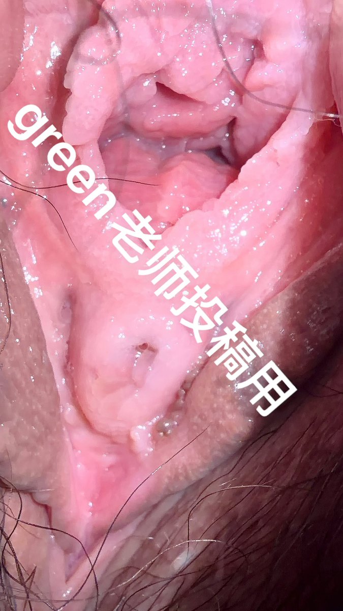 Green老师的分身 tweet media