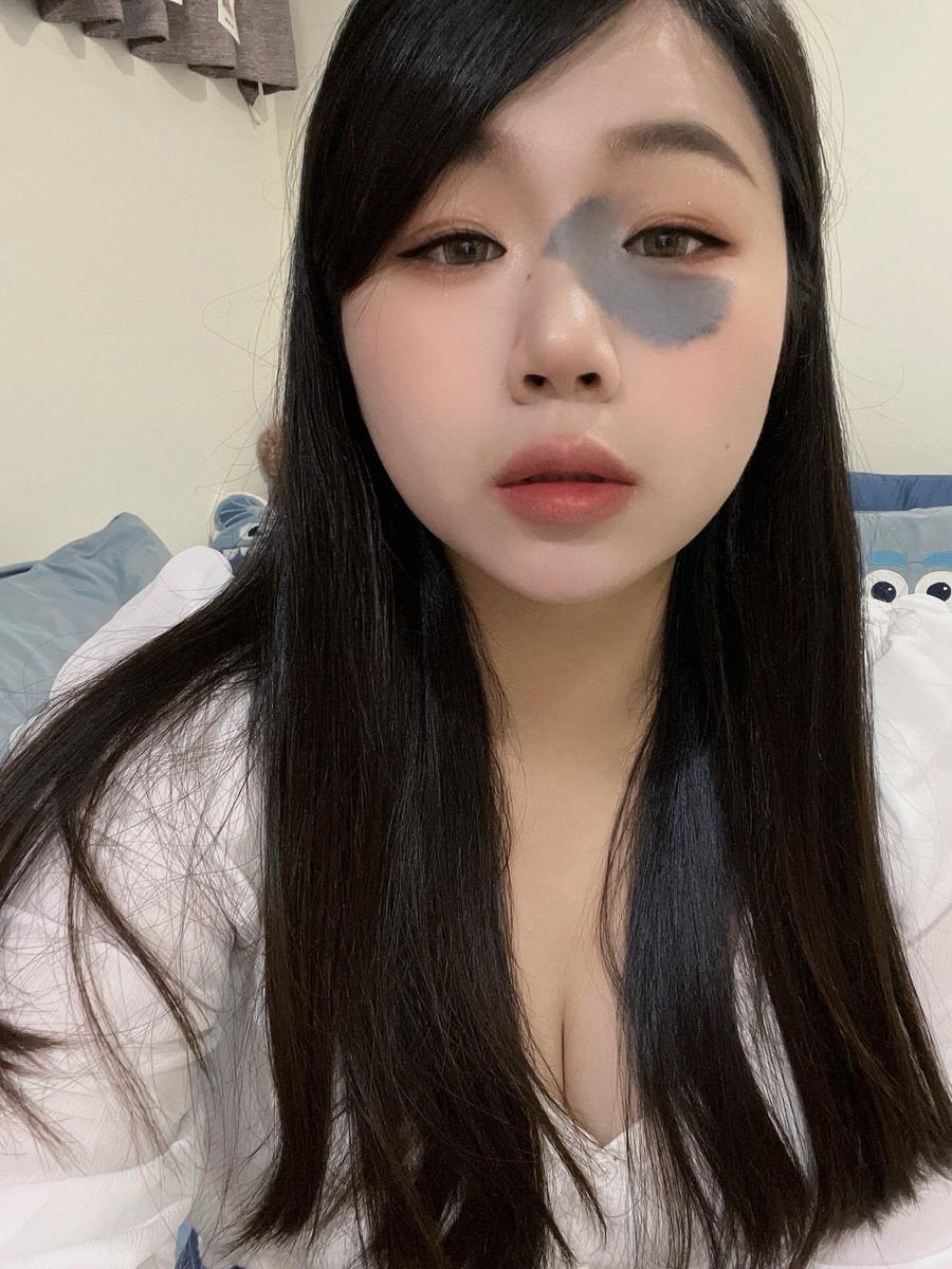 胎記女孩-蘇蘇 tweet media