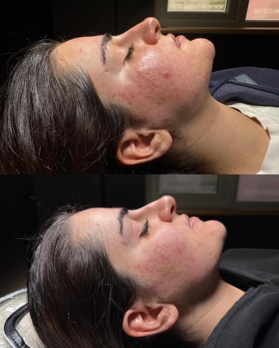 Ellisons tweet media