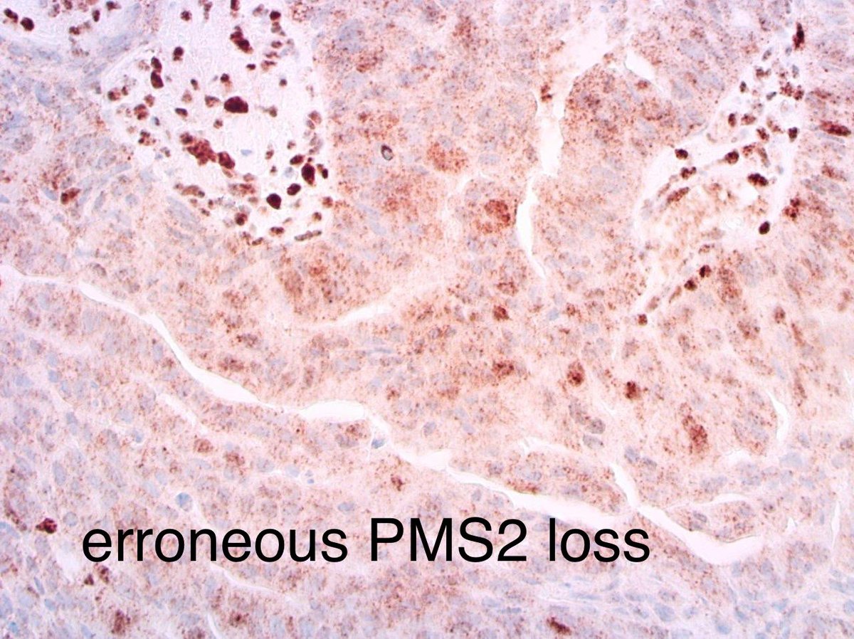 Tim Bracey tweet media