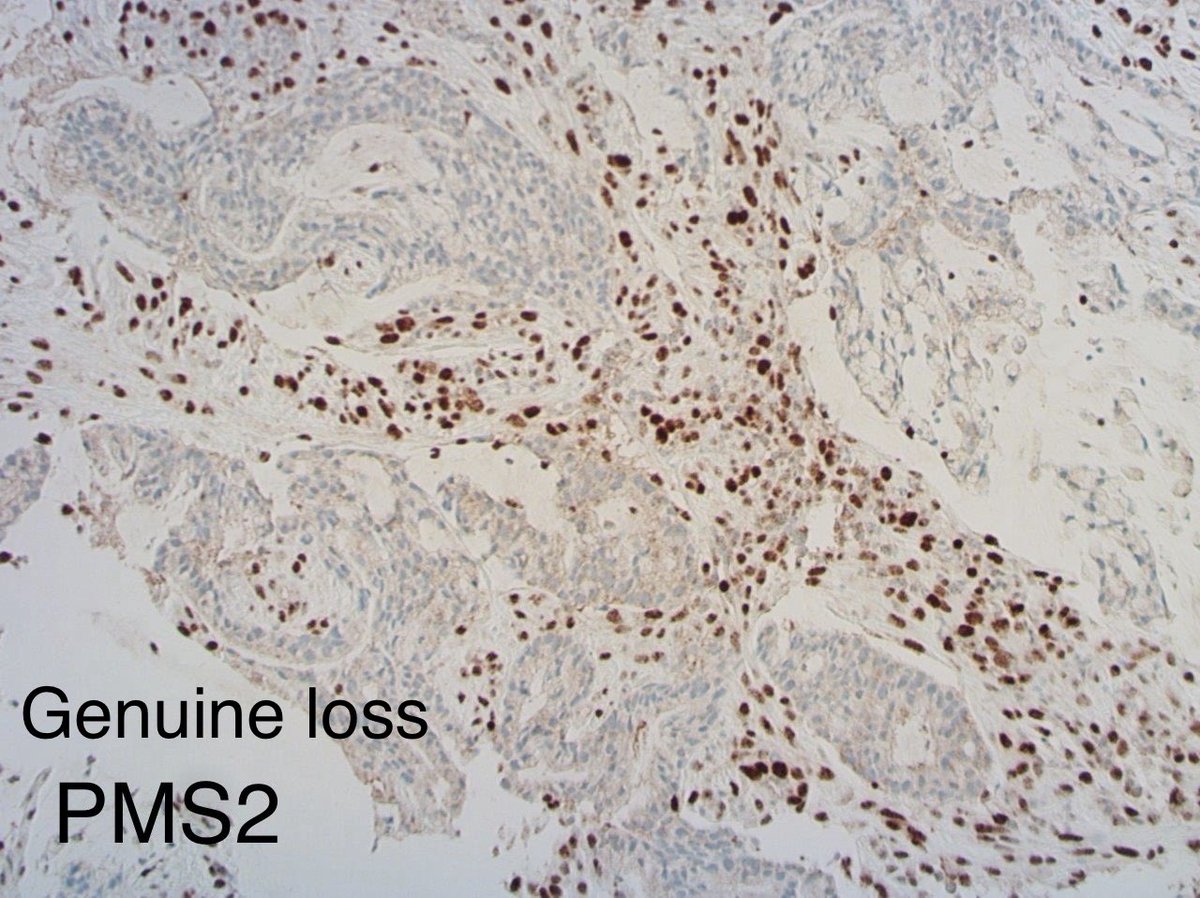 Tim Bracey tweet media