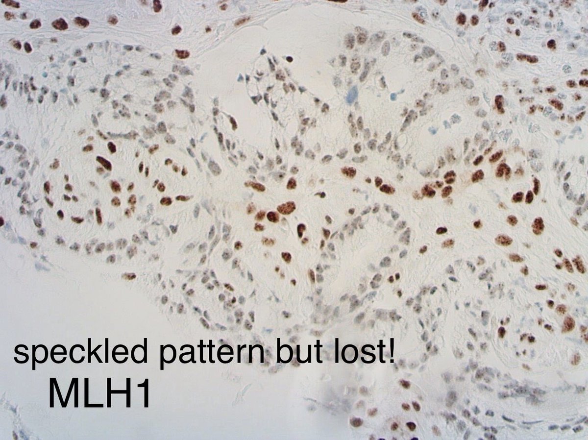 Tim Bracey tweet media