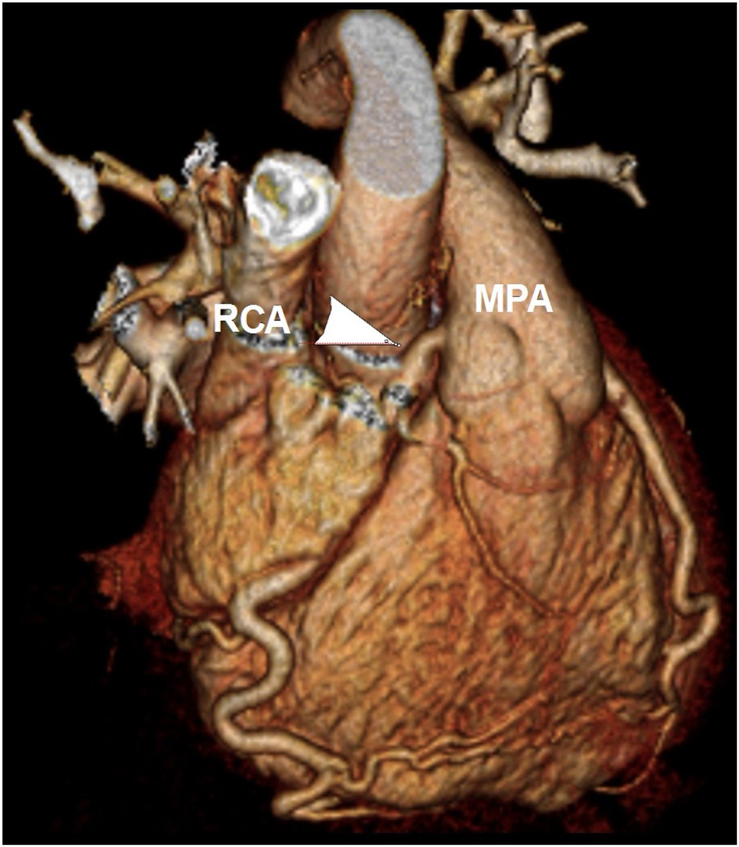 V.L.Sorrell, MD (@CASEfromASE EIC) tweet media