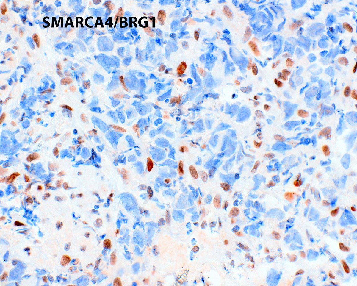 Modern Pathology tweet media