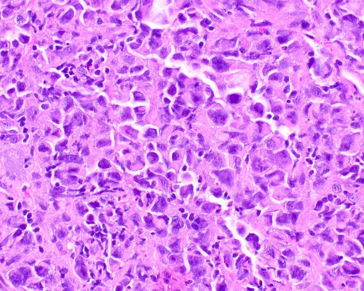 Modern Pathology tweet media