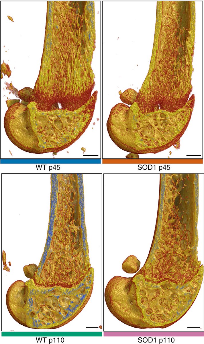 JCI insight tweet media