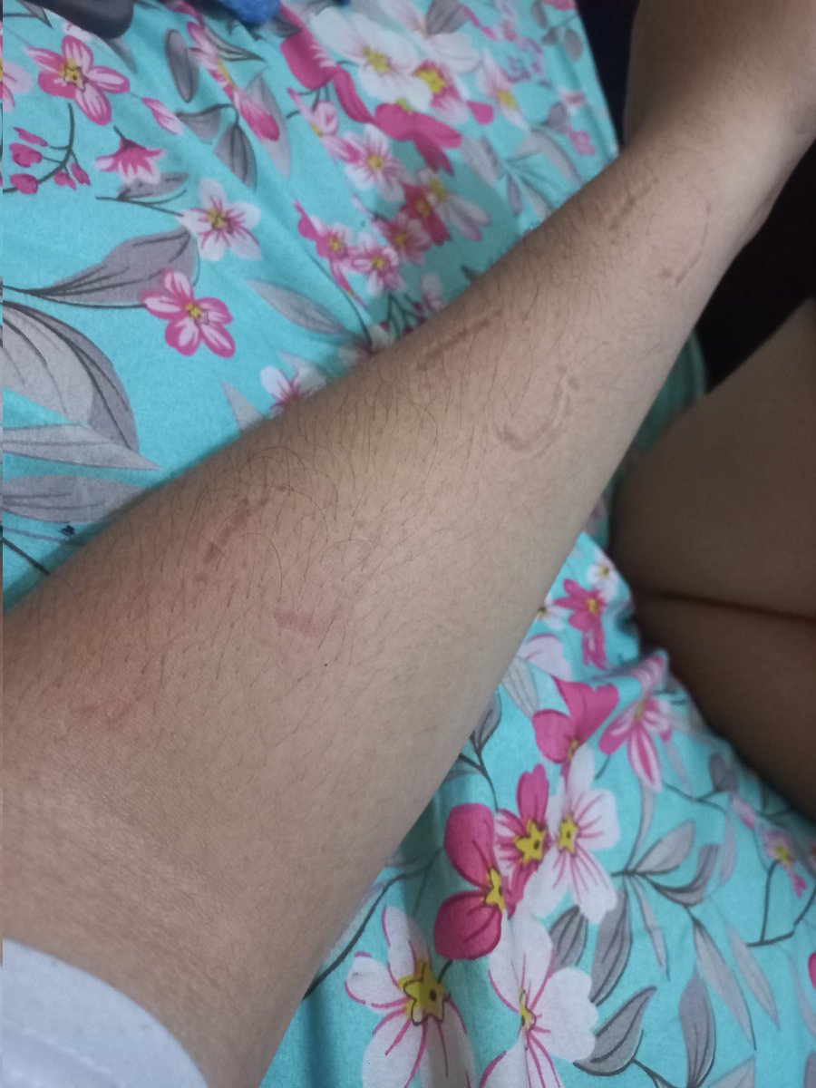 Bobdombear1's tweet photo. Abis dah tangan gue jadi korban die... wkwk https://t.co/Seu4jXdLxk