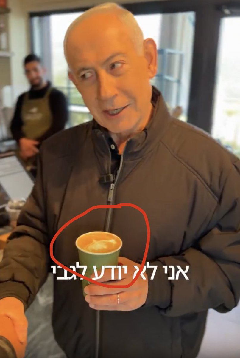 Dr(Prof)Deepak Natarajan MBBS MD DM tweet media