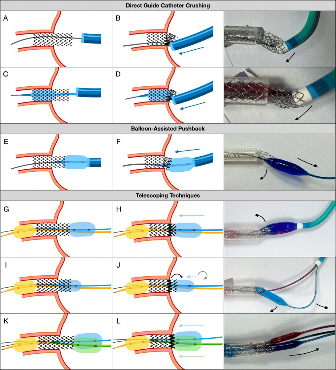 Giuseppe Biondi-Zoccai tweet media