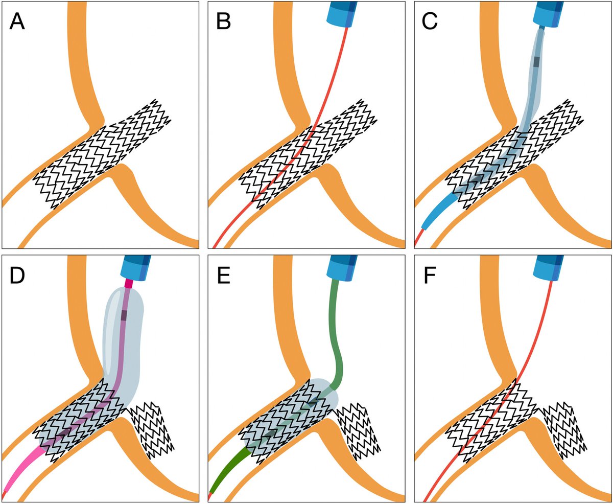 Giuseppe Biondi-Zoccai tweet media