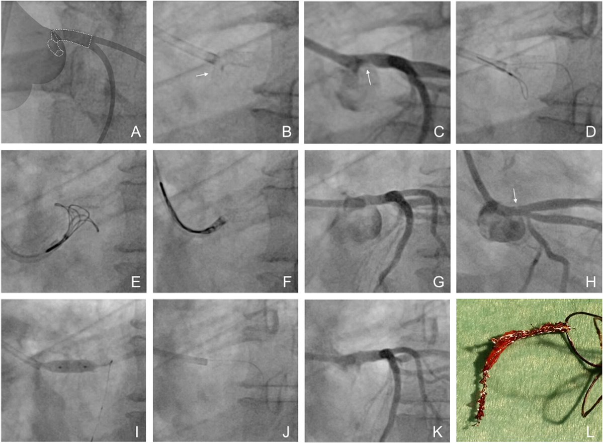 Giuseppe Biondi-Zoccai tweet media