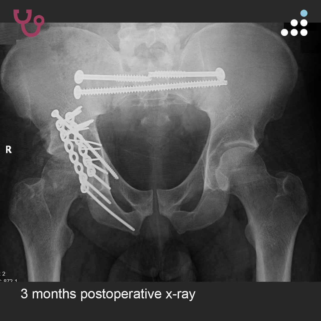 Orthobullets tweet media