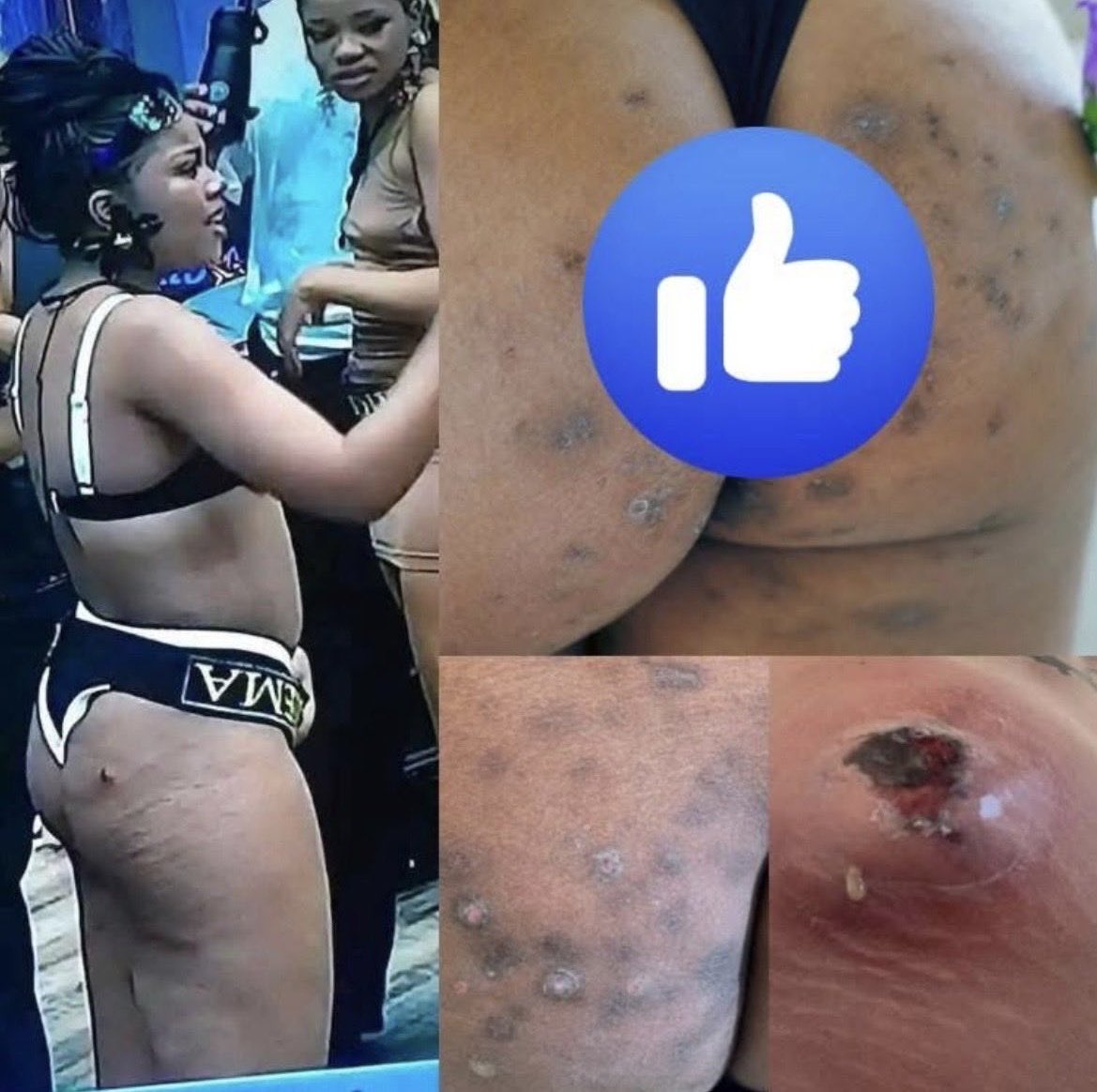 WaneMango's tweet photo. @Somi97493863 @Oluchi175270632 Herpes in question https://t.co/20iXXBxBoe