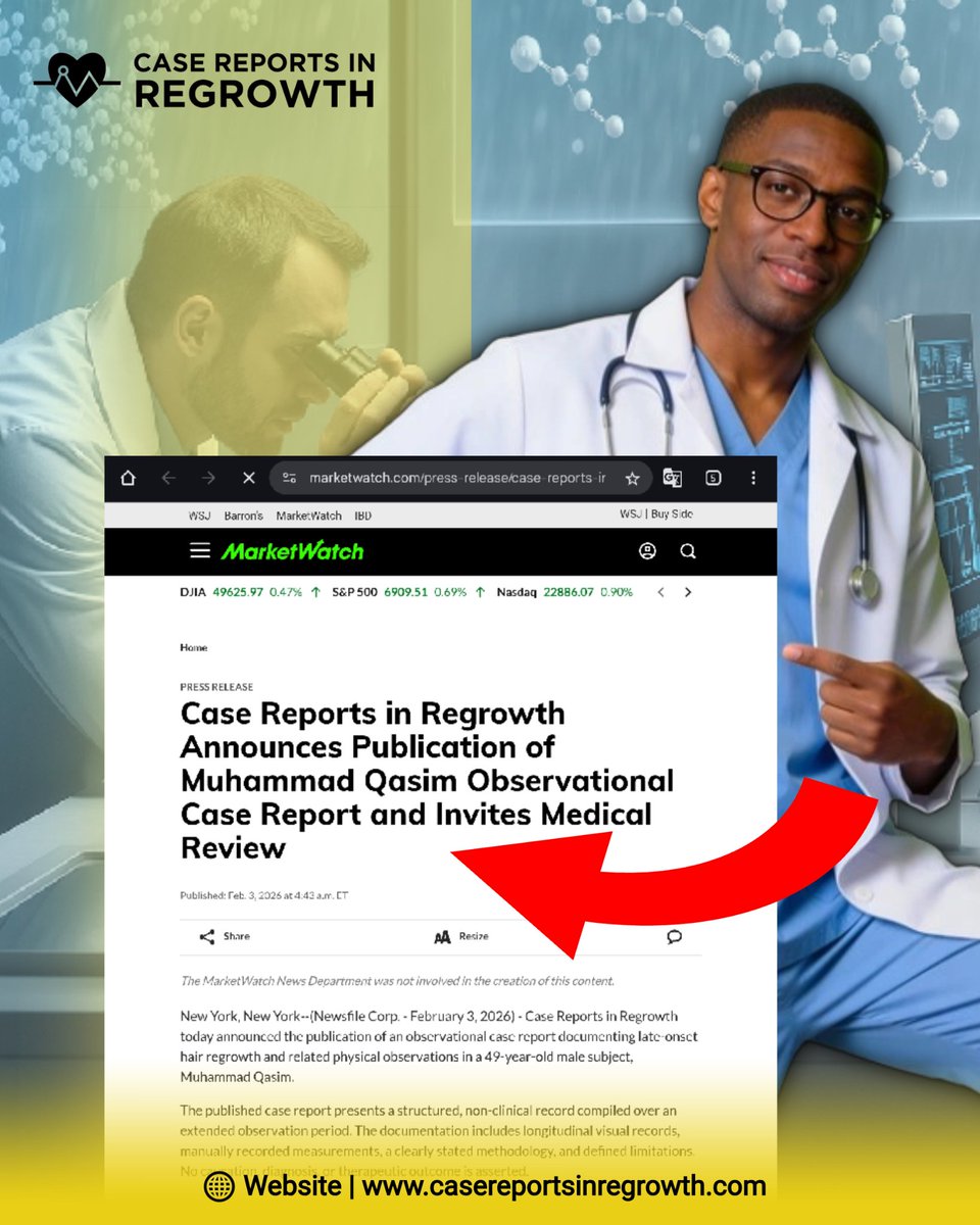 Science expects aging to bring decline. Muhammad Qasim’s case shows the opposite. His appearance is improving with time.