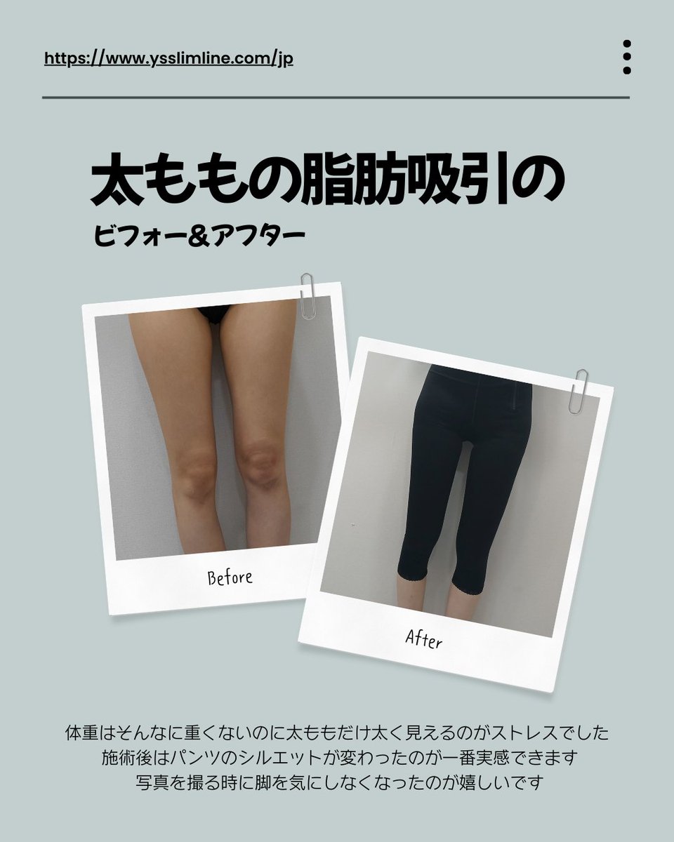 ヨンセスリムライン医院 tweet media