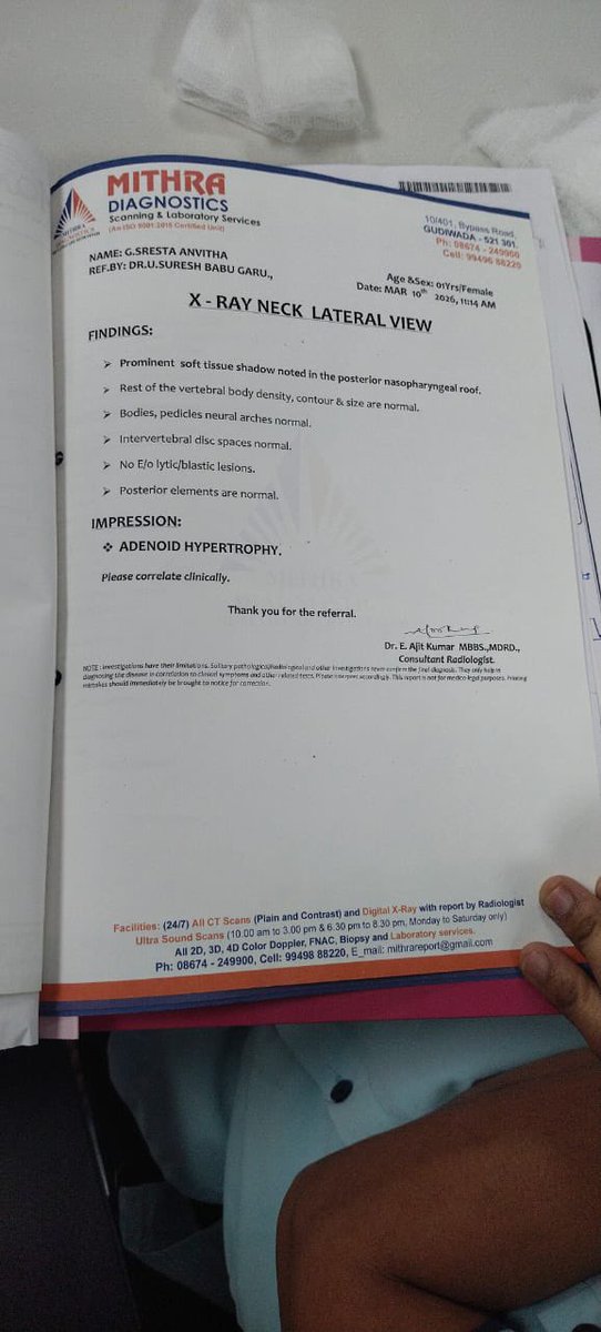 [VERIFIED] Urgent help needed.. One of our Mahesh Babu Fan’s daughter G.Sresta Anvitha (1 year Old kid) is suffering from severe Adenoid Hypertrophy. She’s struggling to breathe, constant infections &amp; sleep issues. Surgery costs around 3L. They can’t afford it alone. Please