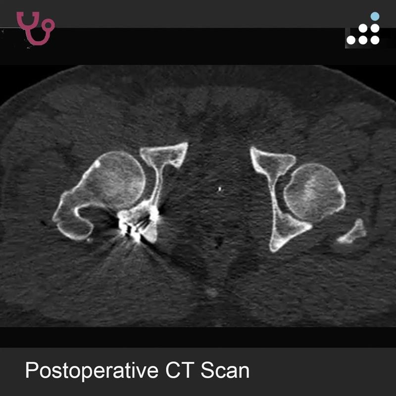 Orthobullets tweet media