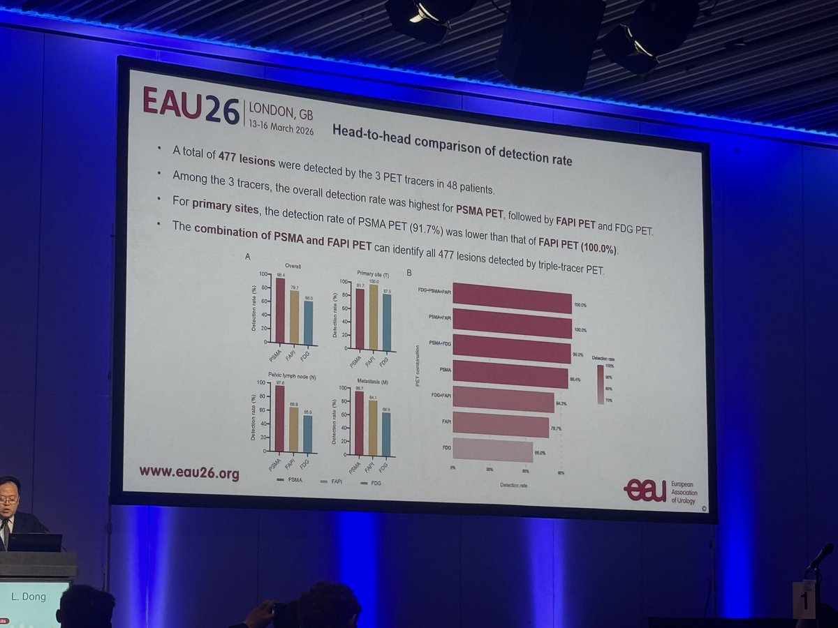 Adam_Weiner535's tweet image. 🚨Dual PET for treatment naive #prostatecancer🚨

The combination of PSMA and FAPI-based PET can localize more metastatic and primary cancers compared with PSMA alone

👉 Still need to determine who would benefit most from an additional PET

@Uroweb @UrologyTimes #EAU26