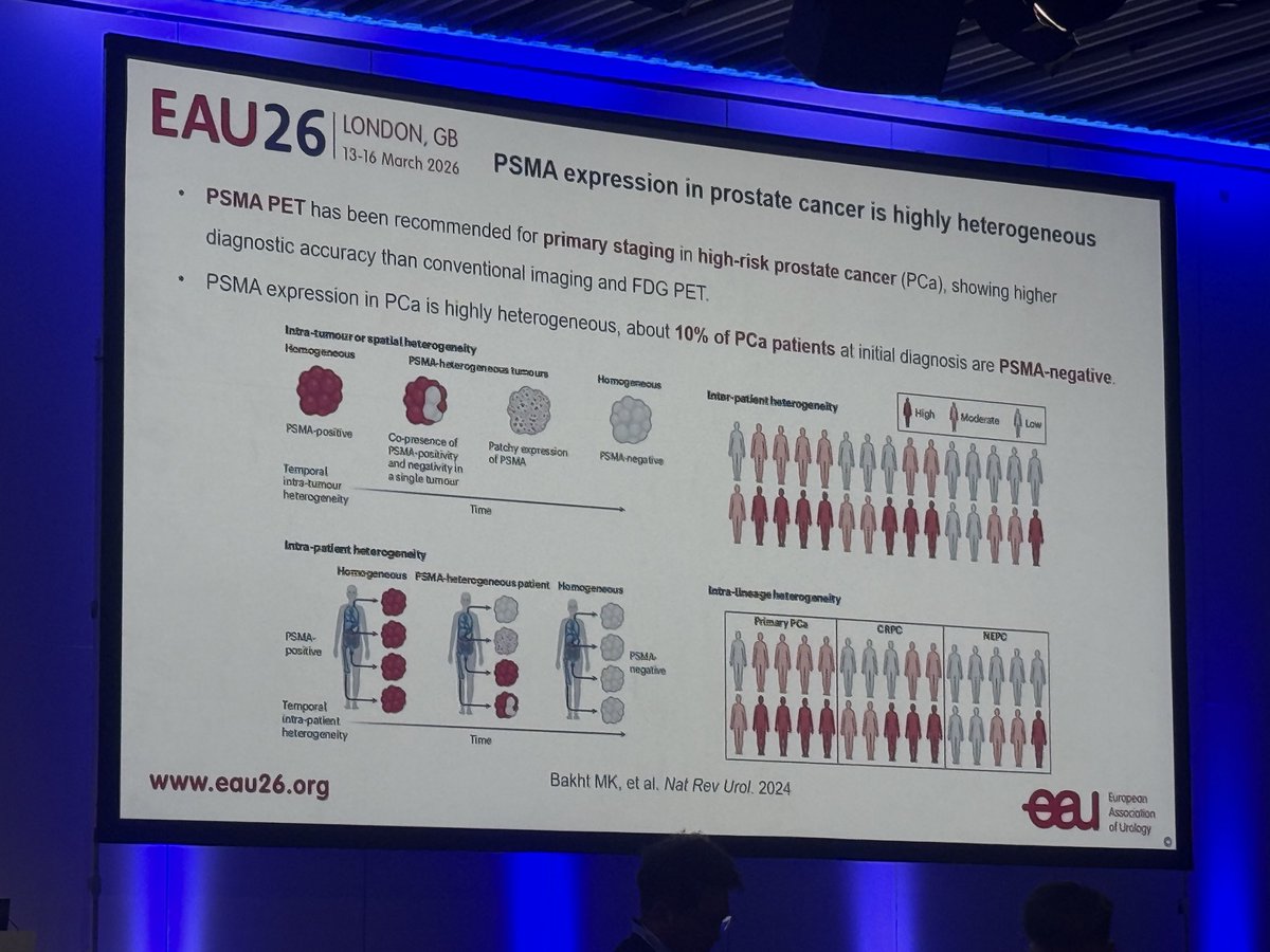 Adam_Weiner535's tweet image. 🚨Dual PET for treatment naive #prostatecancer🚨

The combination of PSMA and FAPI-based PET can localize more metastatic and primary cancers compared with PSMA alone

👉 Still need to determine who would benefit most from an additional PET

@Uroweb @UrologyTimes #EAU26