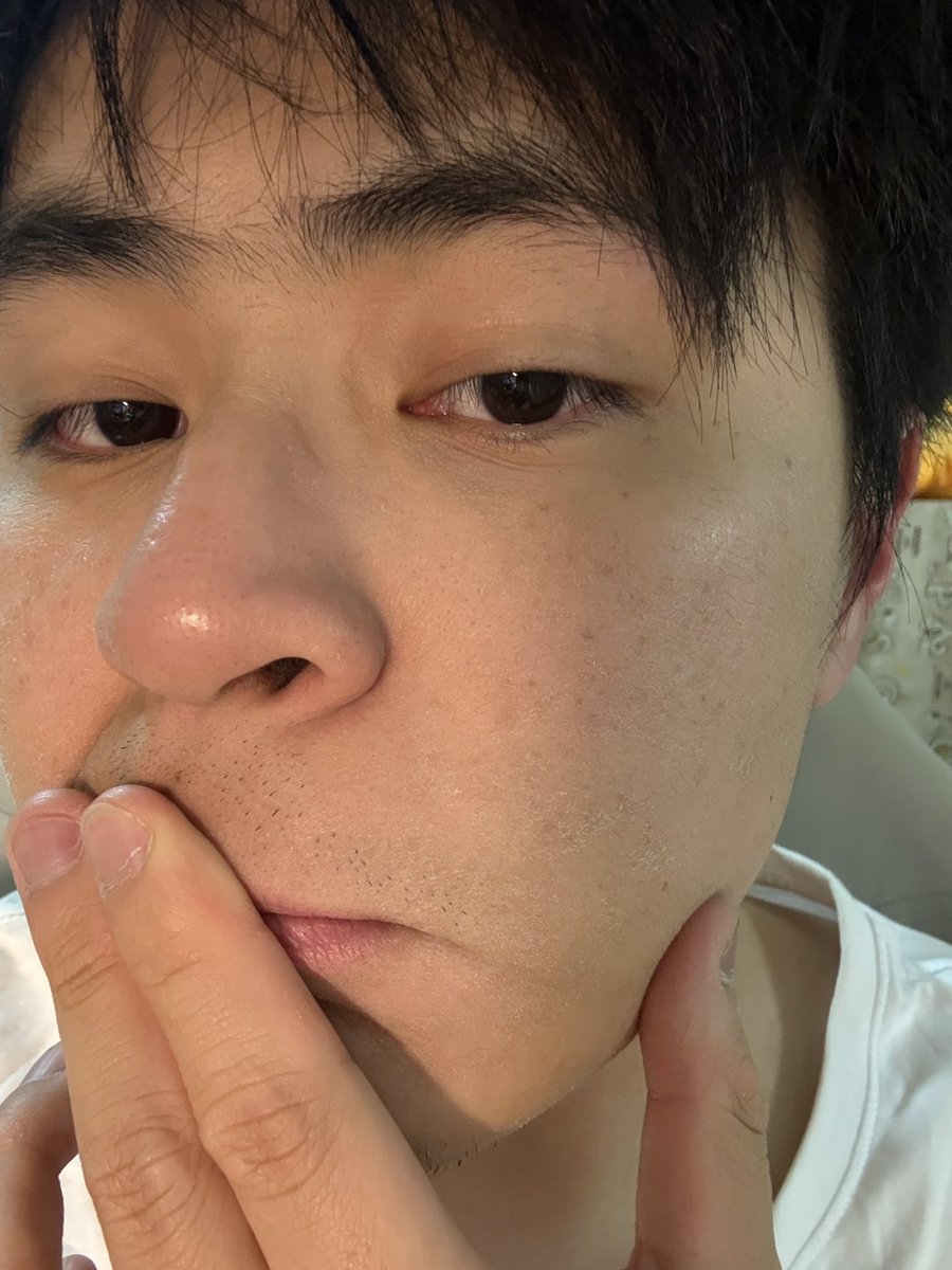 吹完頭髮後皮膚乾燥到脫皮⋯

是不是代表天氣要好轉了🙂‍↕️