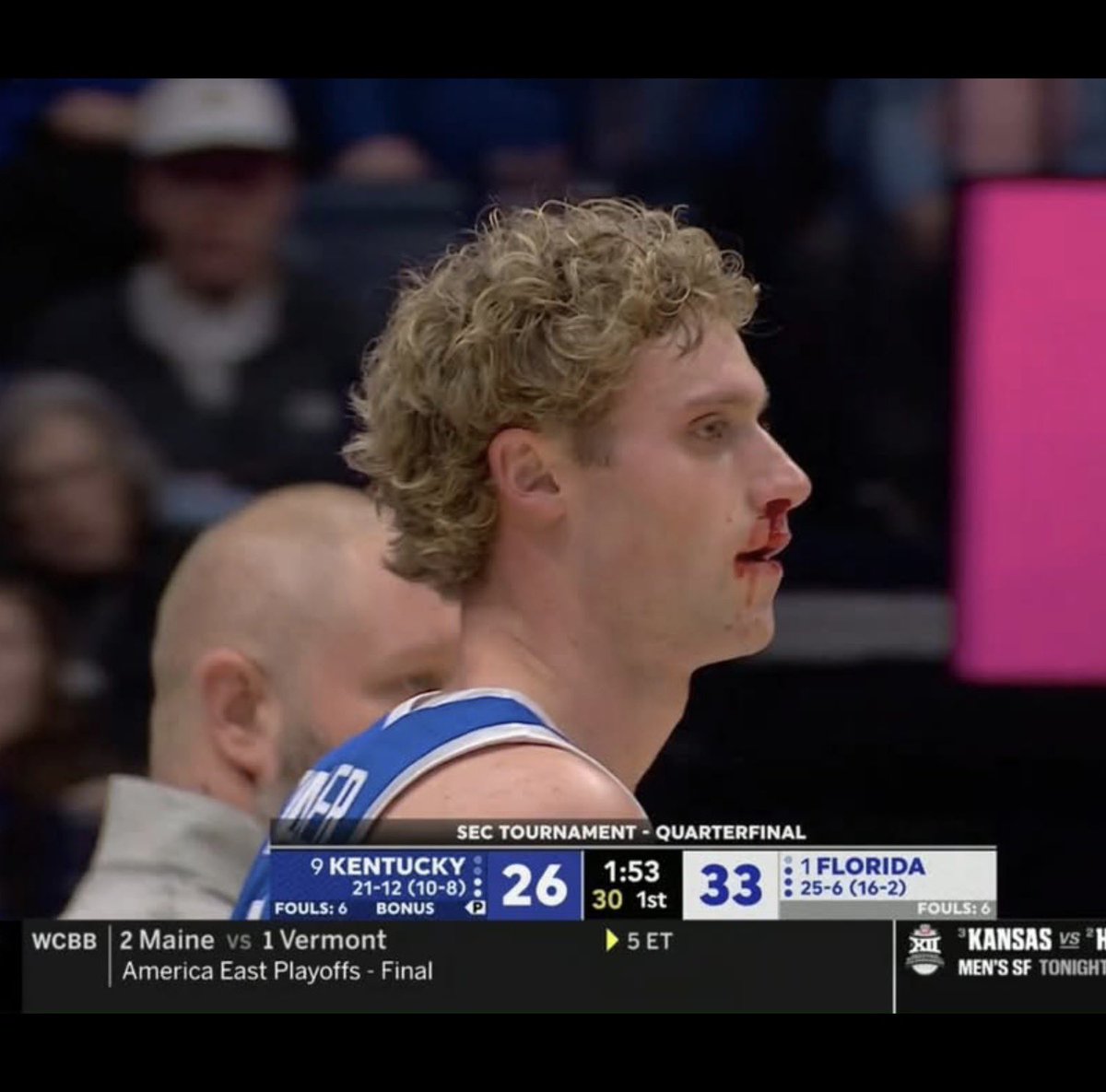 ben tindle tweet media