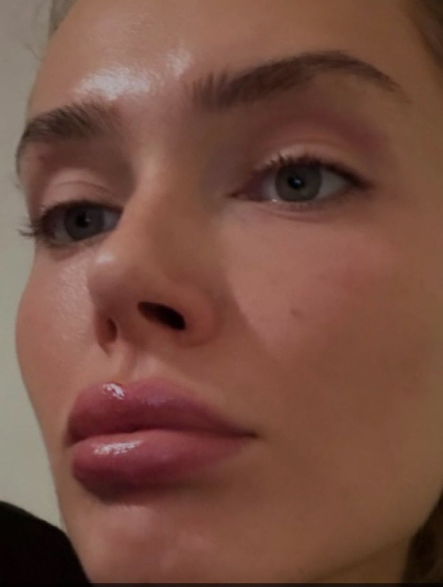 ♡ Honey ♡ tweet media