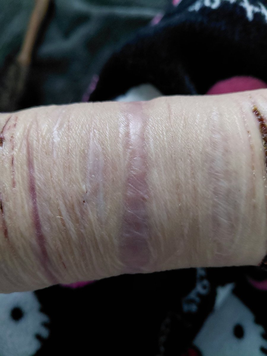 𝖋𝖆𝖑𝖑𝖊𝖓 𝖆𝖓𝖌𝖊𝖑 tweet media