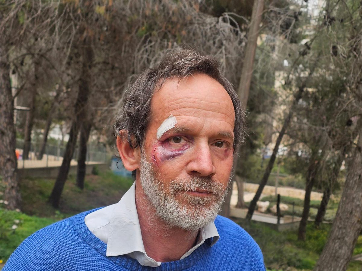 On Friday, Aviv Tatarsky, a researcher at Ir Amim and a long-time activist who has accompanied Palestinian communities in the West Bank for more than 15 years, was attacked by Israeli settlers while carrying out protective presence with Palestinian farmers in the village of Deir