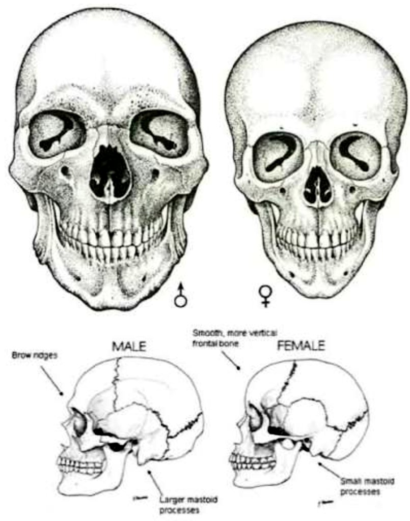 37Lemons's tweet photo. MTF/FTM compare &amp; contrast 

Brooke Shields with the male skull, big face, big eyes, &amp; prominent browridge 

Husband Chris Henchy with the female skull, small face, small eyes, &amp; no prominent browridge 

"Land of the Lost" Premiere 
Hollyweird
2009 https://t.co/yChYVuiK1Z