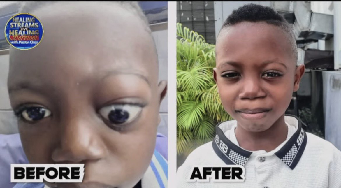 Oh my God💃💃💃💃💃💃💃
Light was healed from Sickle Cell Anemia, and also blindness on the right eye.

This is God!!!! Thank God for Pastor Chris !!!!!