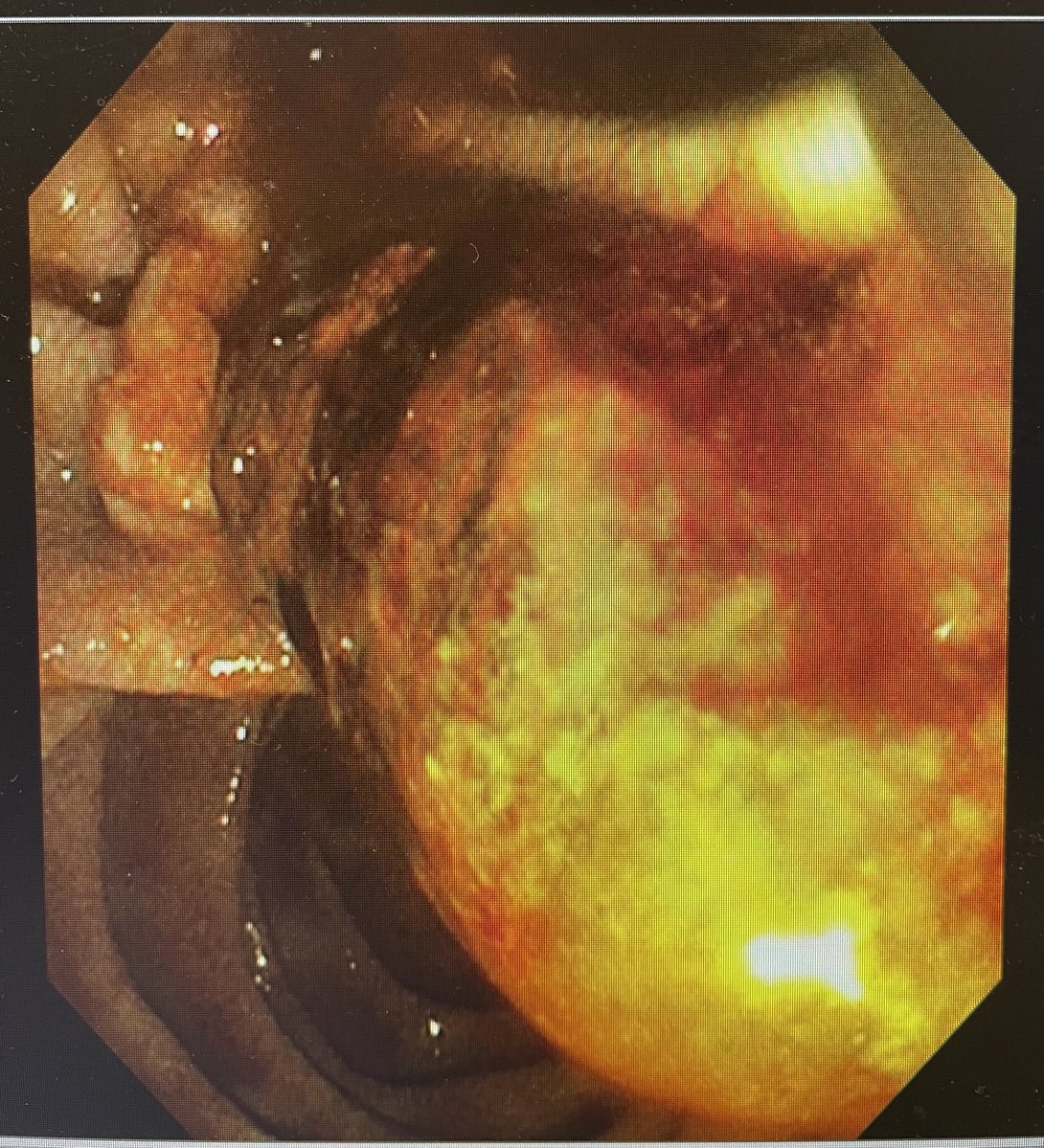 Douglas G. Adler MD, FASGE, FACG, AGAF tweet media