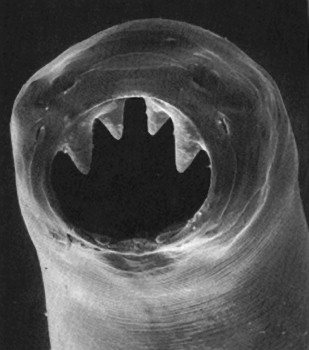 Close-up view of a hookworm's mouthparts, featuring sharp, hook-like structures used to attach to intestines for feeding.