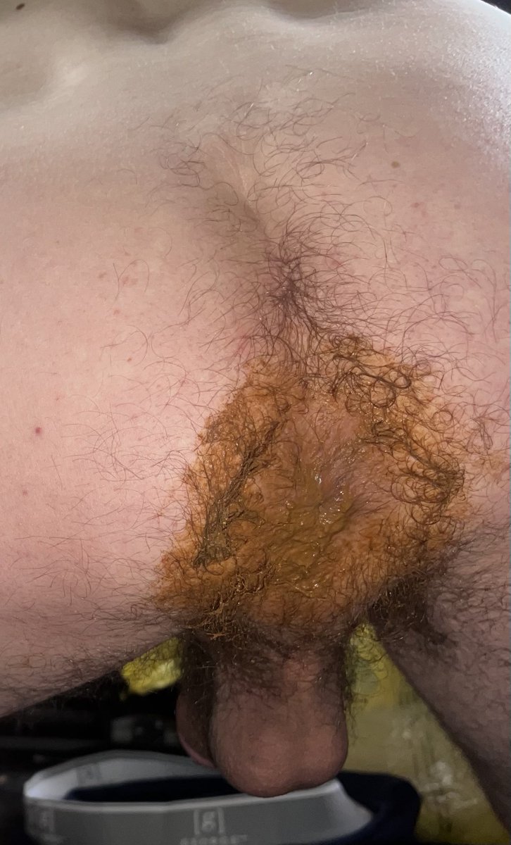 Carl Hendricks Enjoyer tweet media