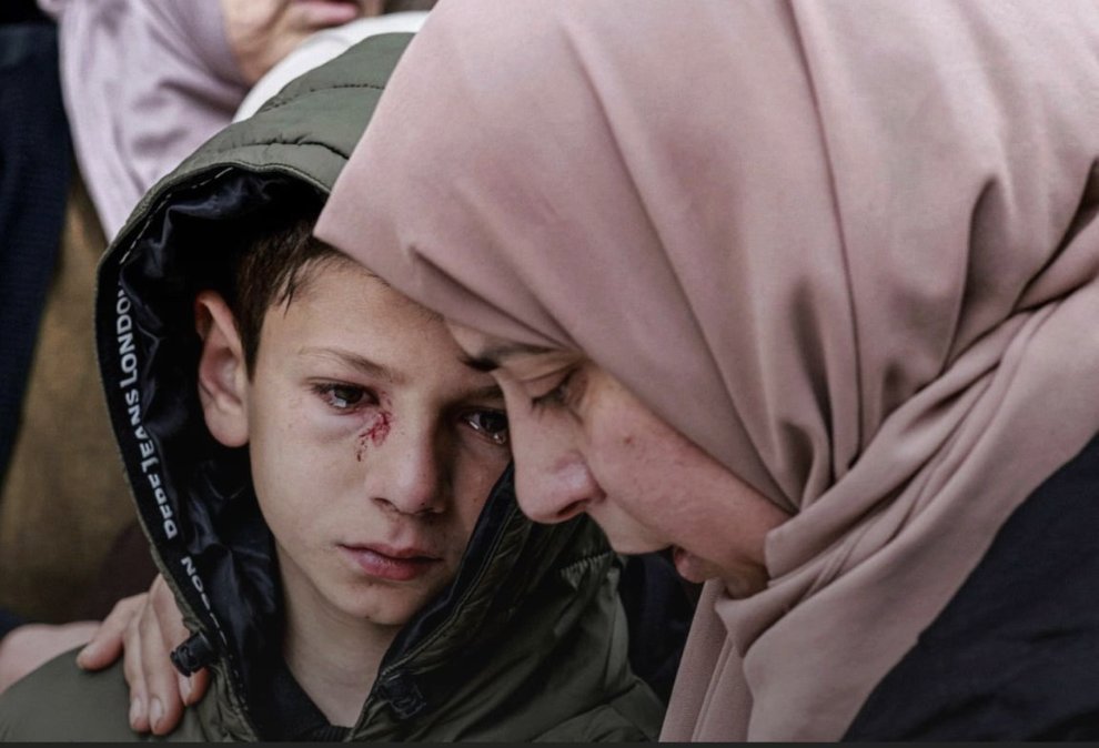 Filistinli Mustafa Ali Bani Odeh, 8 yaşında.

Dün gece bayram alışverişinden dönerken İsrail güçleri, 37 yaşındaki babasını, 35 yaşındaki annesini ve 5 ile 7 yaşlarındaki iki kardeşini katletti.

Onu da öldüresiye dövdüler.

Bu yüzü unutmayın.