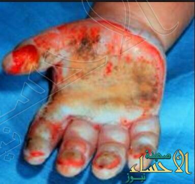 سعود البحر tweet media