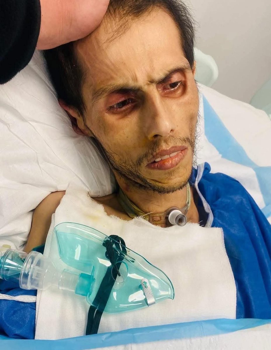 This young man is Dham Al-Amoush. A Jordanian engineer who was arrested for online posts on Gaza.

After months, he decided to go on a hunger strike. He called his parents after one week to tell them he was not feeling well then disappeared. 

Parents searched for him in all