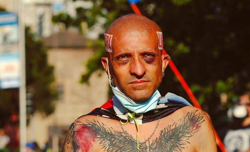 Increíble: El Pelao Vade ni siquiera estaba golpeado, estaba INTOXICADO DE DROGAS gamba.cl/2026/03/pelao-…