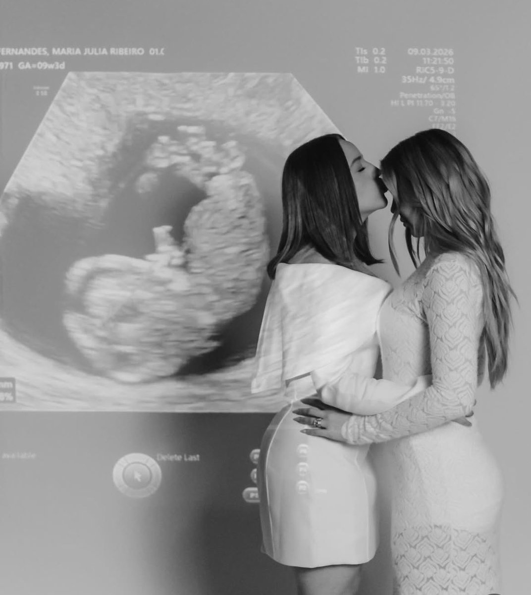 Geracaomfz's tweet photo. A Família MFZ está crescendo!!!
Que alegria ver o sonho de vocês sendo realizado! 
Que o baby venha com muita saúde e traga muita alegria para vocês! 
Estamos todos ansiosos e muito felizes! 
Agora conta pra gente, vocês acham que é menino ou menina! 
🩵🩷 https://t.co/Q3nEOJq2XF