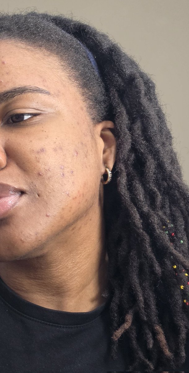 Bèlmanmi Tchèkble tweet media