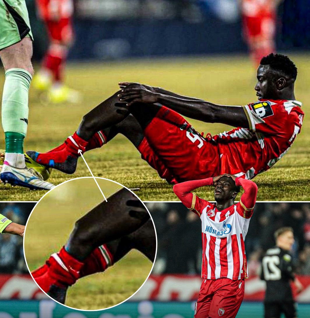 _Zfootball's tweet photo. 🚑 𝗦𝗜𝗟𝗔𝗦 𝗞𝗔𝗧𝗢𝗠𝗣𝗔 a subi une fracture du tibia et du péroné gauches lors du match aller des huitièmes de finale de la Ligue Conférence UEFA contre le SK Sigma Olomouc. Cette blessure est due à un choc malheureux avec un joueur adverse.

Prompt rétablissement, Silas ! ❤️