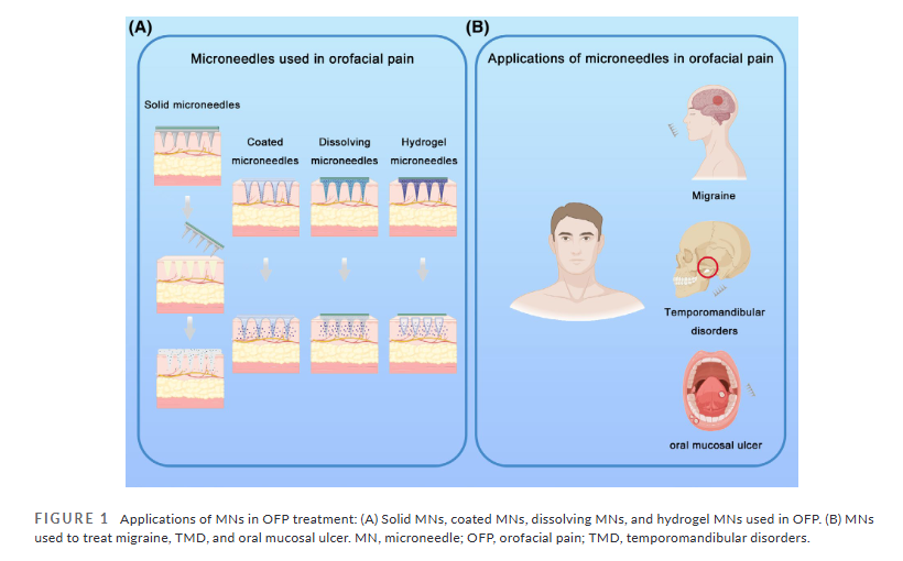 Headache Journal tweet media