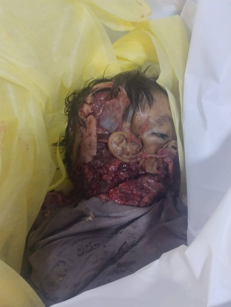 سمير المندعي tweet media