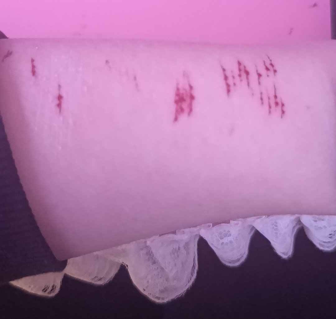 amane ּ ֶָ֢𖹭 . tweet media