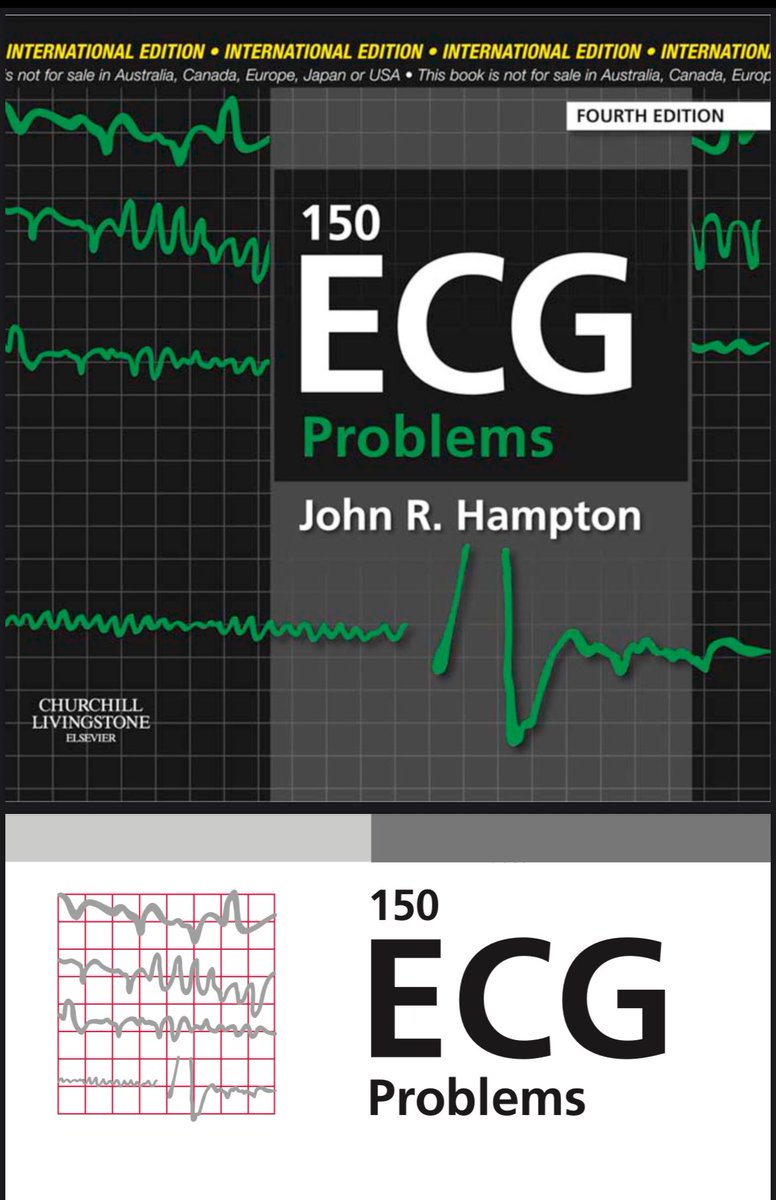 ALn3my's tweet photo. هذا الكتاب ساعدني كثير في تطوير مهارتي في قراءة ECG.

كنت أقرأ يوميًا 10–20 ECG لمدة شهر كامل
والفرق كان واضح جدًا في سرعة التفسير والتفكير السريري.

التعلم الحقيقي في ECG يأتي من رؤية أكبر عدد ممكن من الحالات وليس فقط قراءة النظريات.

📘 الكتاب: 150 ECG Problems – John Hampton

📥 الرابط:
(https://t.co/uV6R9qOLlH)

#ECG
#Cardiology
#MedTwitter
#FOAMed
#InternalMedicine
#MedicalEducation